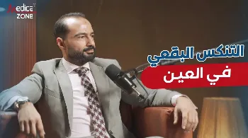 ما هو التنكس البقعي؟ وكيف يؤثر في القدرة على الإبصار؟